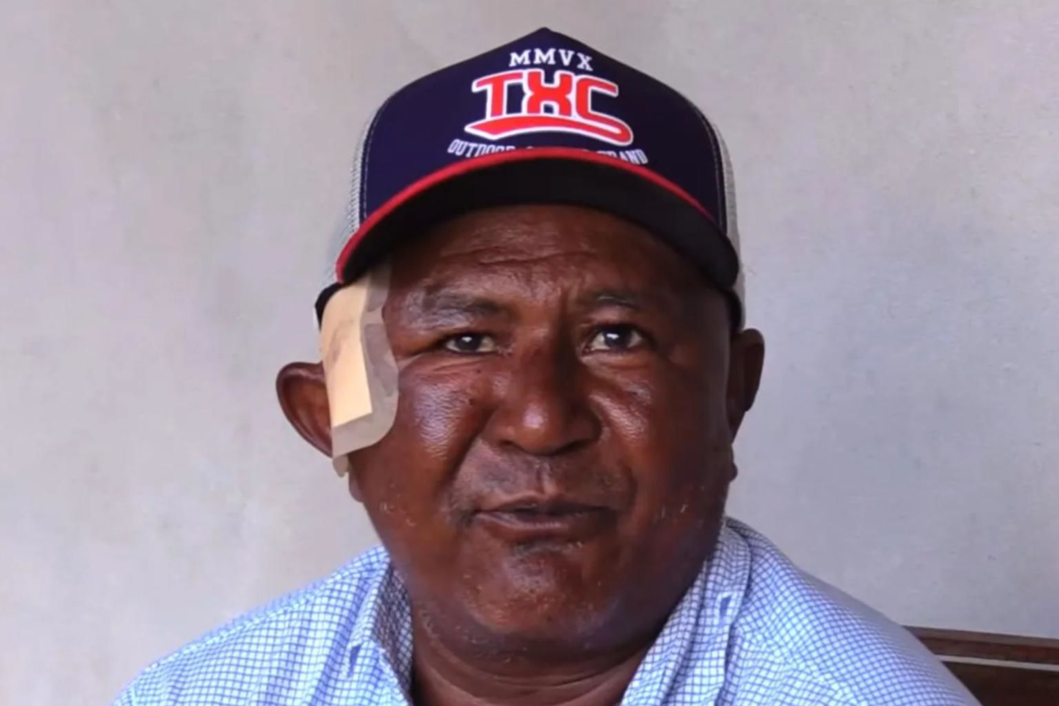 В Бразилии мужчина чудом выжил после схватки с ягуаром, напавшим на ...